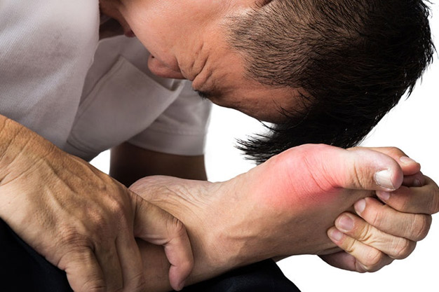 آیا نقرس بیماری پولدارهاست؟