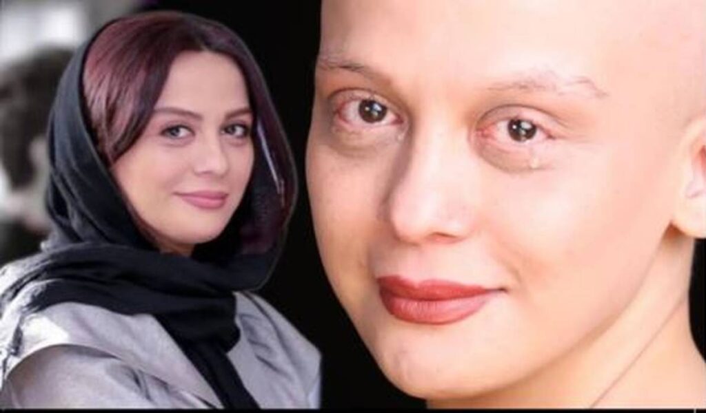 بیوگرافی تلخ مارال فرجاد؛ از سرطان تا سیمرغ بلورین جشنواره فجر