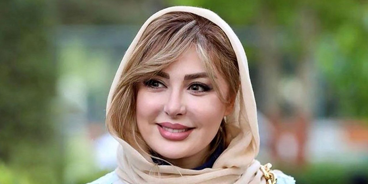 جدیدترین عکس نیوشا ضیغمی بعد از عمل دوباره بینی!