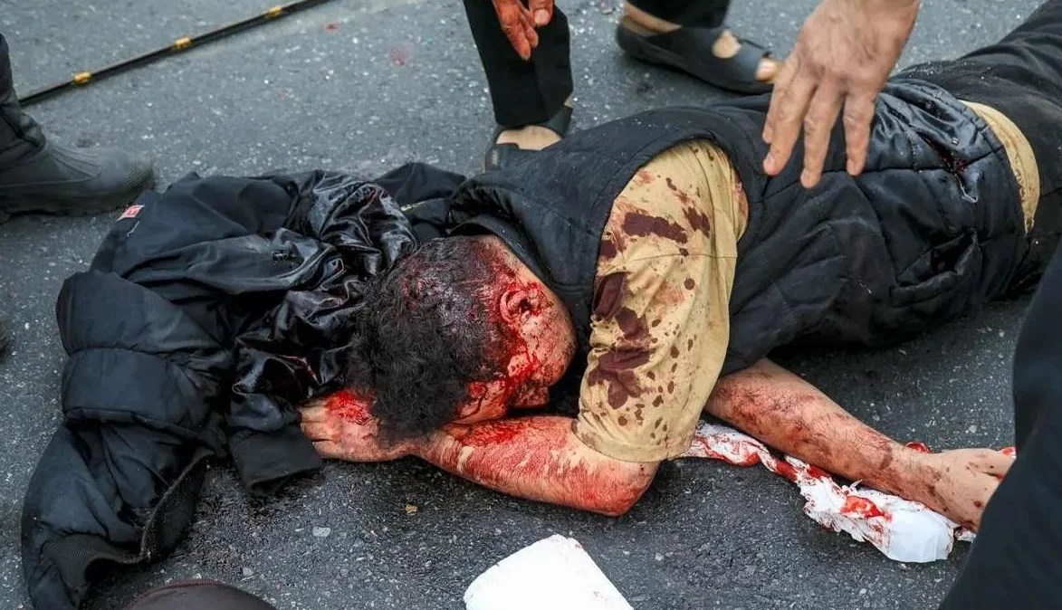 تصاویر دلخراش از حمله موشکی به اتوبان شهید باقری تهران