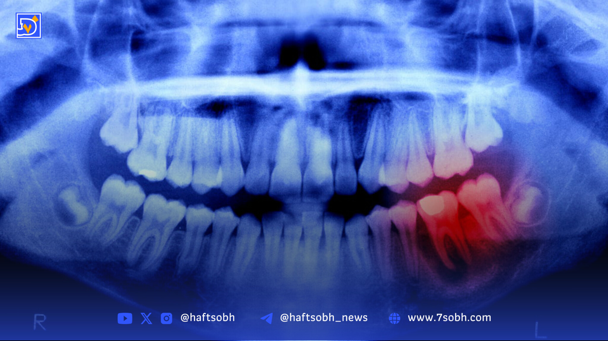 انسان‌ها تا ۴ سال آینده می‌توانند دندان‌های جدید رشد دهند
