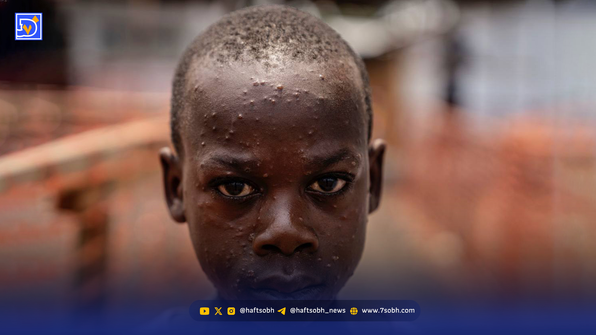 جهانی‌ بی‌پناه‌تر | مرگ اضافی بیش از ۷۵۰‌هزار نفر در جهان