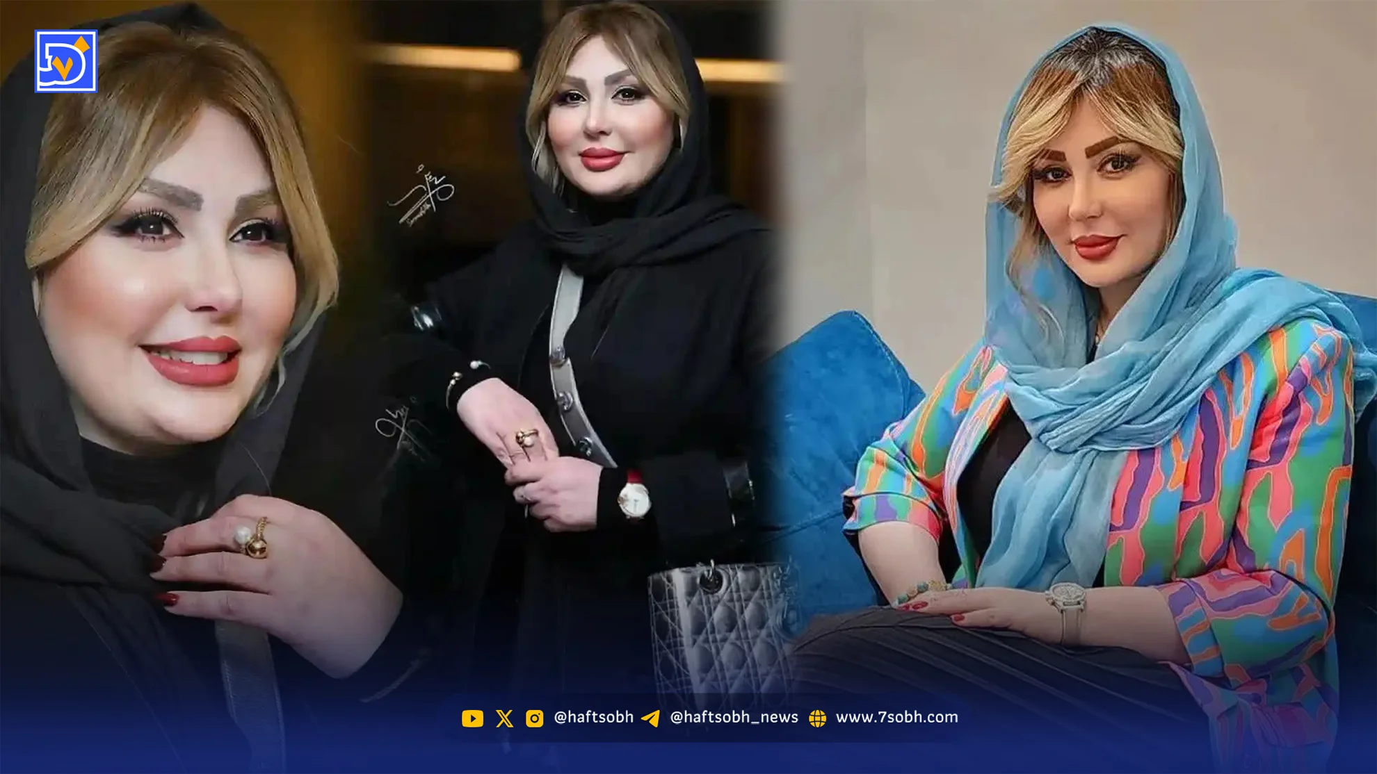نیوشا ضیغمی از تجربه بوتاکس و نگاهش به جذابیت مردان گفت