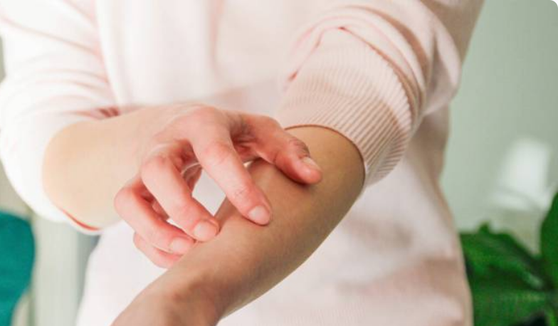 بهترین دارو برای خارش بدن چیست؟