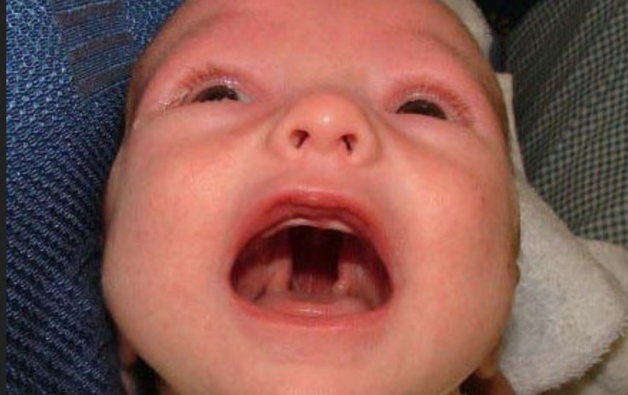 بهترین معجون برای درمان گلو درد چرکی کودکان