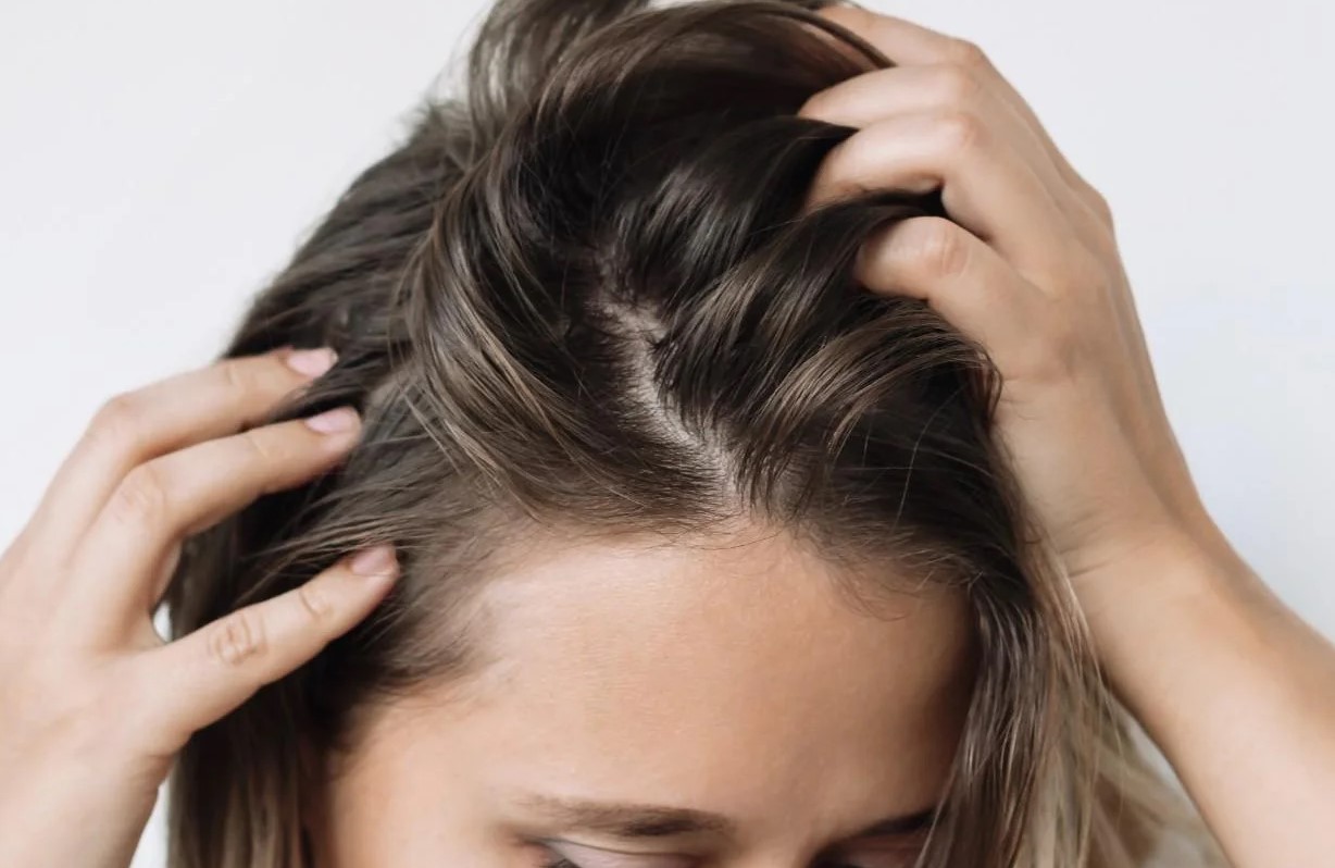 چگونه از چرب شدن پوست سر جلوگیری کنیم؟