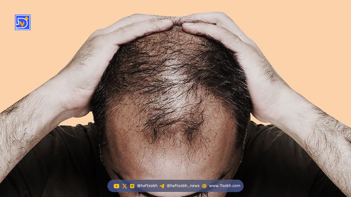 کمبود کدام ویتامین باعث ریزش مو می شود؟