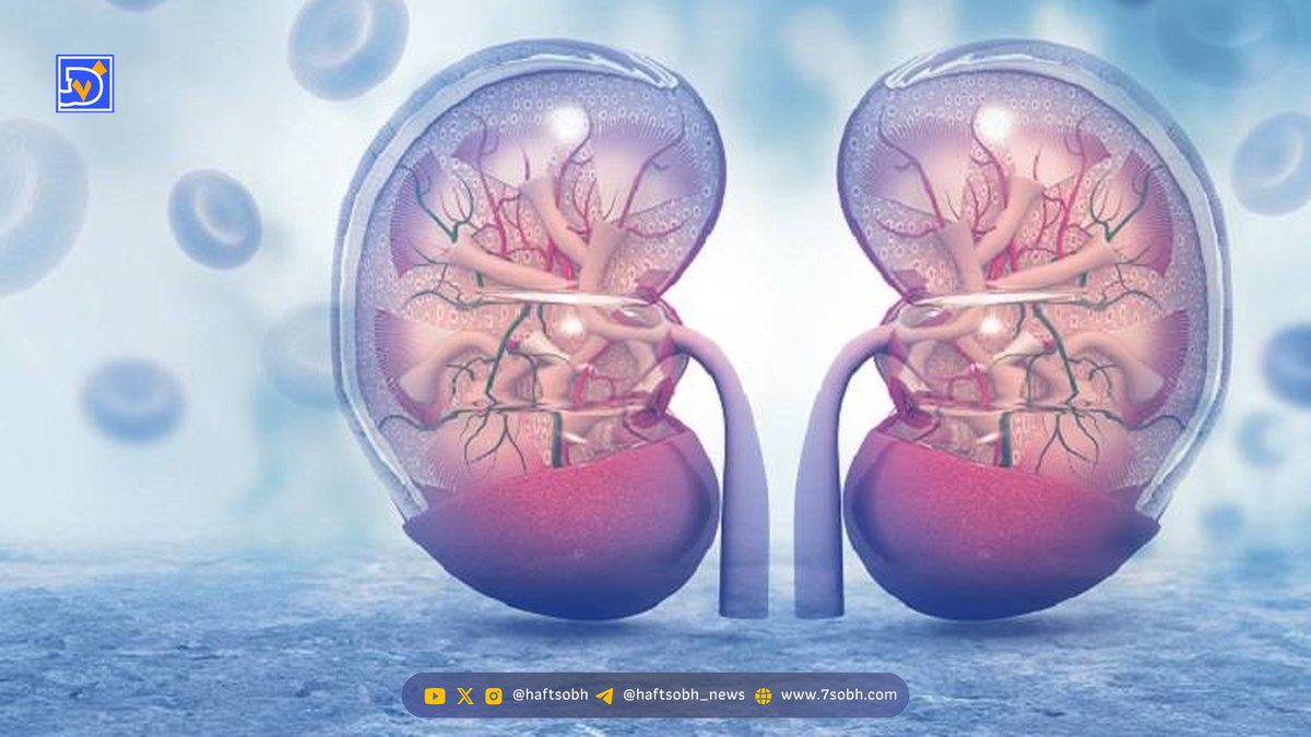 این داروها میتوانند باعث نارسایی کلیه شوند؛ مراقب باشید/ علائم نارسایی کلیه